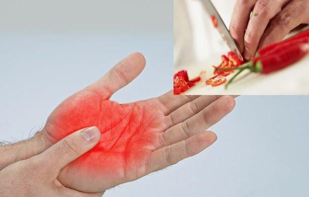 πώς να απαλλαγείτε από τον πόνο της πιπεριάς στο χέρι