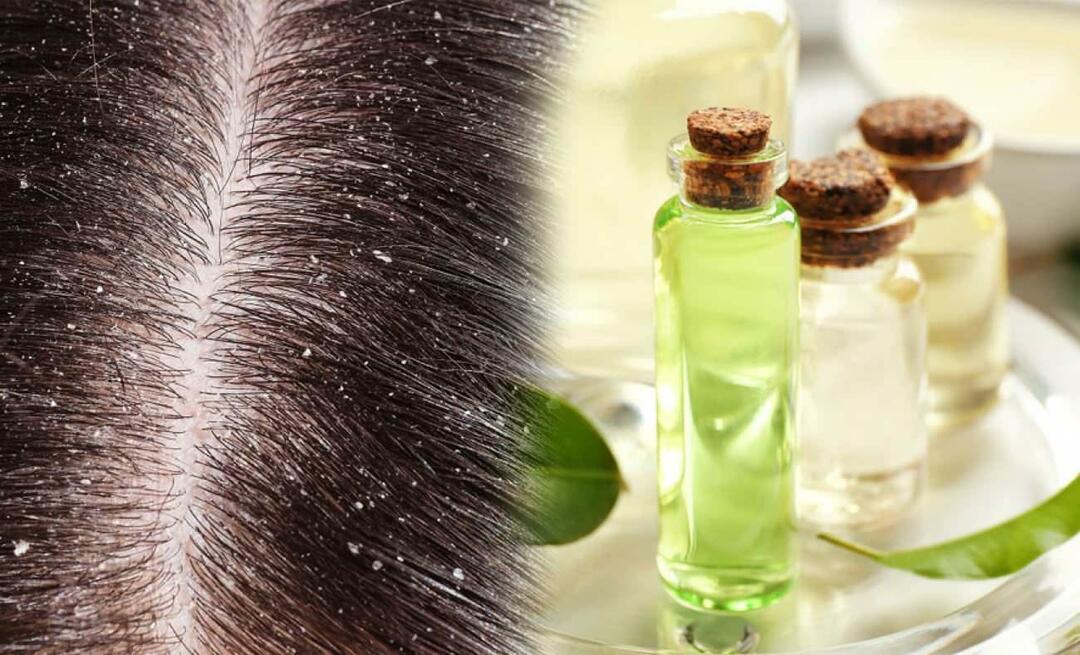 Μπορείτε να χρησιμοποιήσετε λάδι δέντρου τσαγιού για την πιτυρίδα; Μπορείτε να εφαρμόσετε λάδι δέντρου τσαγιού στα μαλλιά σας και είναι καλό;