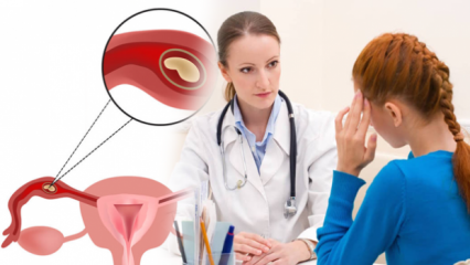 Τι είναι η έκτοπη κύηση (έκτομη κύηση), γιατί; Ποια είναι τα σημάδια της έκτοπης εγκυμοσύνης;