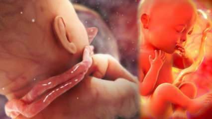 Τι είναι η εμπλοκή καλωδίου; Μπλέξιμο κορδονιού γύρω από το λαιμό του μωρού στη μήτρα της μητέρας