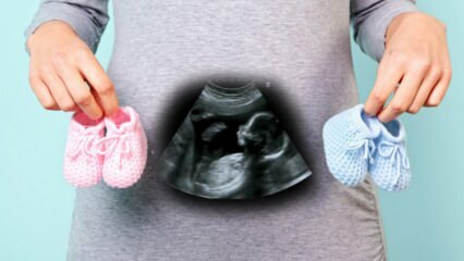 Θα προσδιοριστεί το φύλο του μωρού κατά το πρώτο τρίμηνο της εγκυμοσύνης;