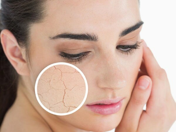 Γιατί στεγνώνει το δέρμα; Τι πρέπει να κάνετε στην ξηρή επιδερμίδα; Οι πιο αποτελεσματικές συμβουλές φροντίδας για ξηρό δέρμα
