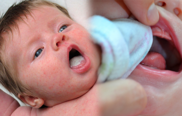 Πώς είναι οι πληγές στο στόμα στα μωρά