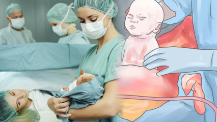 Πώς είναι μια καισαρική γέννηση; Πόσες φορές πραγματοποιείται καισαρική τομή, είναι επικίνδυνη; Μετά από καισαρική τομή