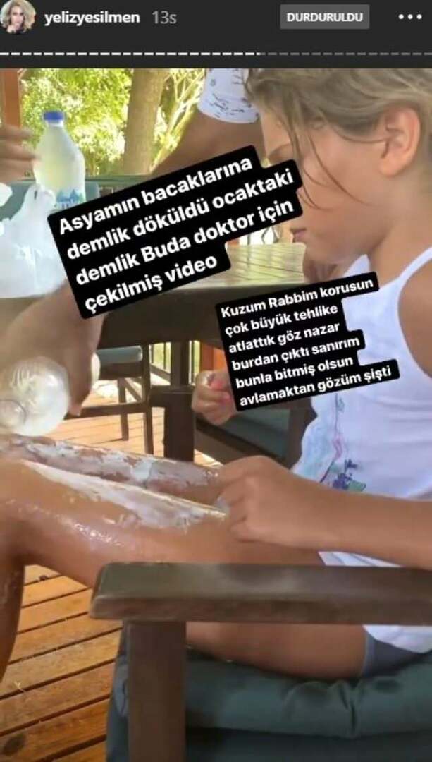 Βραστό νερό χύθηκε στα πόδια της κόρης του Yeliz Yeşilmen