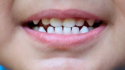 Πώς να διδάξω την οδοντιατρική φροντίδα των παιδιών;