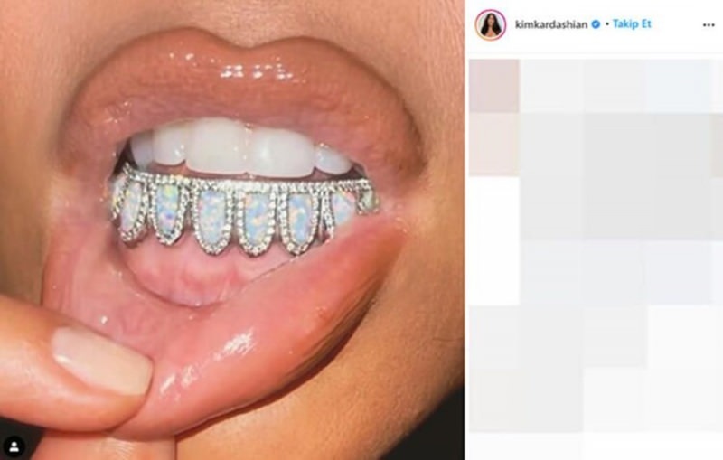 Οδοντικό στολίδι της Kim Kardashian