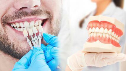 Γιατί εφαρμόζεται καπλαμάς ζιρκονίου στα δόντια; Πόσο ανθεκτική είναι η επίστρωση ζιρκονίου;