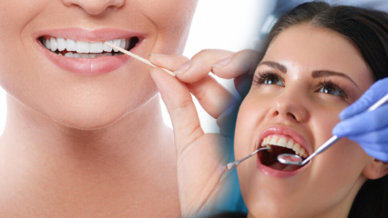 Πώς να διατηρήσετε τη στοματική και στοματική υγεία; Τι πρέπει να προσέχετε κατά τον καθαρισμό των δοντιών;