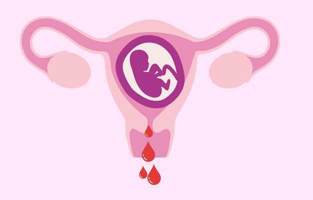 αιτίες αιμορραγίας κατά τη διάρκεια της εγκυμοσύνης