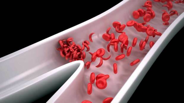 ευερεθιστότητα και κούραση αυξάνεται καθώς τα κύτταρα του αίματος μειώνονται