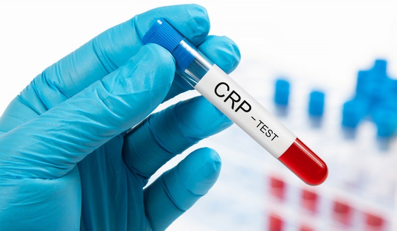Γιατί αυξάνεται το CRP στο αίμα; Τι είναι το CRP; Πώς να μειώσετε το CRP;