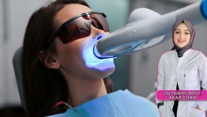 Πώς γίνεται η μέθοδος λεύκανσης δοντιών (Bleaching); Η μέθοδος της λεύκανσης βλάπτει τα δόντια;