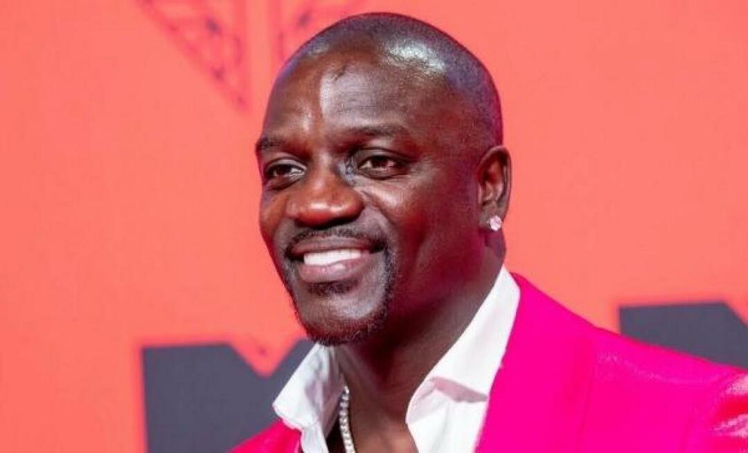 Η αμερικανίδα τραγουδίστρια Akon προτίμησε και την Τουρκία για μεταμόσχευση μαλλιών! Ιδού το τίμημα που πλήρωσε...