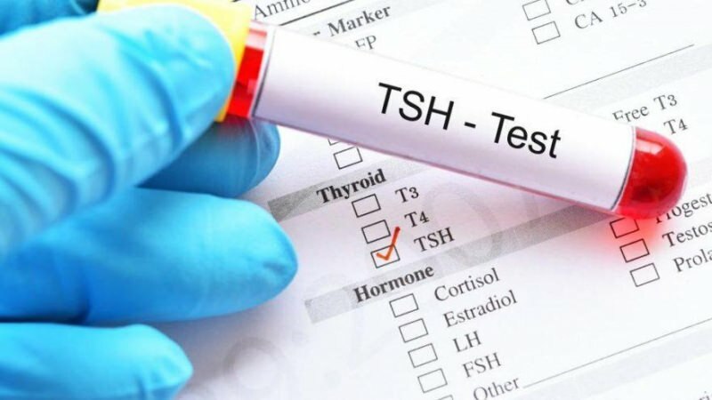 Το τεστ tsh είναι ένα τεστ ορμονών