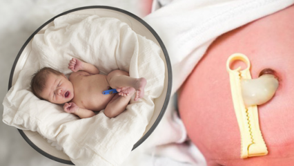Τι είναι το Placenta Previa; Πώς να κάνετε τη φροντίδα του ομφάλιου λώρου στα μωρά; Εάν ο ομφάλιος λώρος είναι πολύς ...