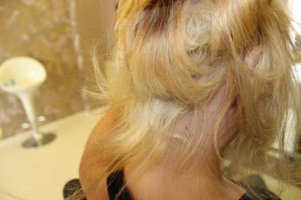 Τι γίνεται με την καύση των μαλλιών από τη μέση; Πώς θα πρέπει να διατηρούνται τα επεξεργασμένα μαλλιά;