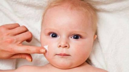Συμβουλές φροντίδας δέρματος για μωρά! Ποια είναι τα προβλήματα του δέρματος στα μωρά;