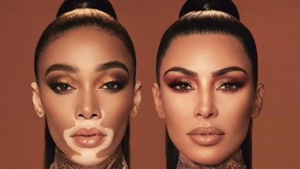 Η Kim Kardashian και η Winnie Harlow έγιναν διαφημιστικά πρόσωπα στο ίδιο πλαίσιο!