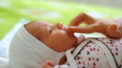 Φυσικές θεραπείες που προκαλούν κακώσεις αφθούς στα μωρά! Πώς περάσουν οι πληγές από την αφαίρεση;