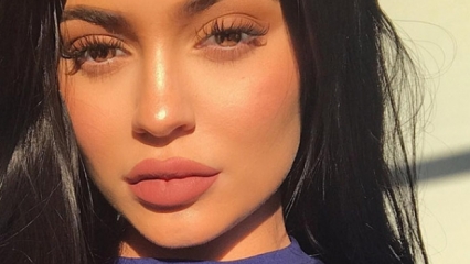 Τα χείλη της Kylie Jenner αξίζουν την τύχη
