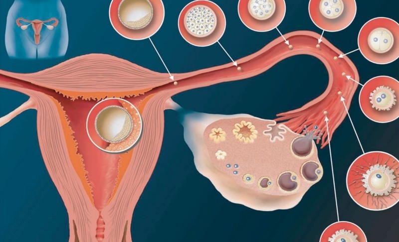 Είναι η αιμορραγία από τοποθέτηση ένα σημάδι εγκυμοσύνης; Πώς διευθετείται η αιμορραγία;