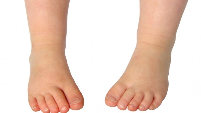 Τα 3 πιο συνηθισμένα προβλήματα στην υγεία των ποδιών