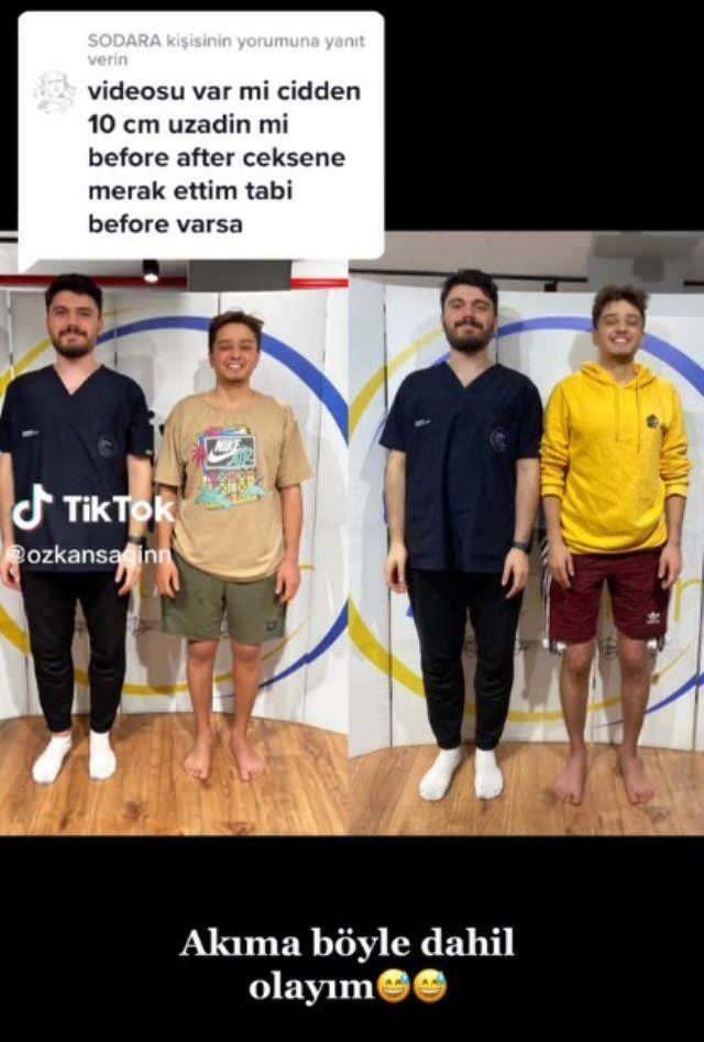 Ο Özkan Sağın έκανε πριν και μετά την επέμβαση