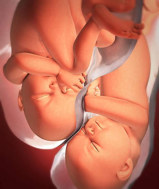 Ποια είναι τα συμπτώματα της διπλής εγκυμοσύνης;