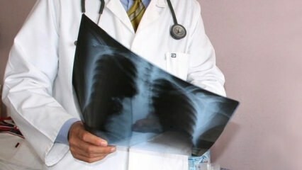 Ειδικοί ανακοίνωσαν! Αύξηση των θανάτων από καρκίνο του πνεύμονα