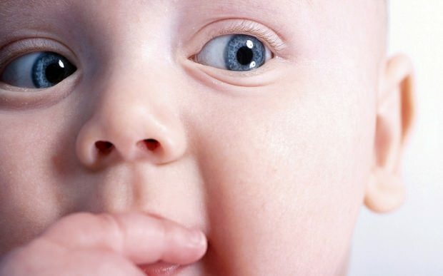 Γιατί η μετατόπιση των ματιών στα μωρά;