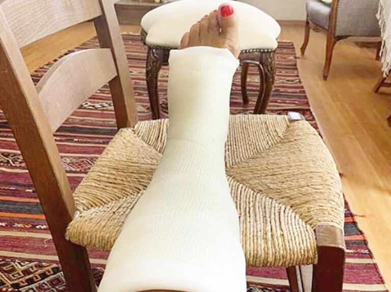 Ο κύριος καλλιτέχνης Ayşe Kökçü έσπασε το πόδι της
