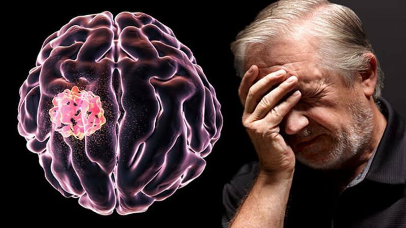 Ο ιστός που σχηματίζεται στον εγκέφαλο λόγω της διακοπής των κυτταρικών δομών ονομάζεται όγκος.