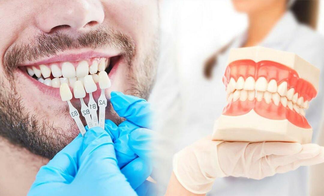 Γιατί εφαρμόζονται στεφάνες ζιρκονίου στα δόντια; Πόσο ανθεκτική είναι η επίστρωση ζιρκονίου;