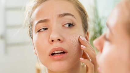 Γιατί στεγνώνει το δέρμα; Τι πρέπει να κάνετε στην ξηρή επιδερμίδα; Οι πιο αποτελεσματικές συμβουλές φροντίδας για ξηρό δέρμα