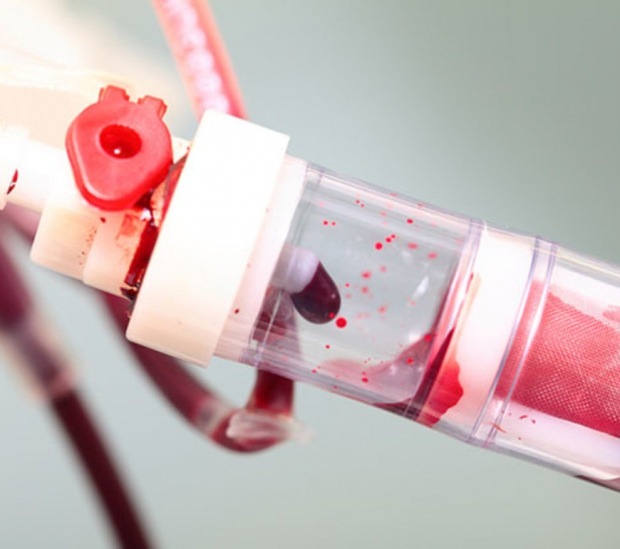 Τι είναι τα χαμηλά επίπεδα αιμοπεταλίων (PLT); Ποια είναι τα συμπτώματα της ανεπάρκειας αιμοπεταλίων;