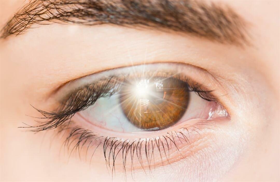 Τι προκαλεί λάμψεις φωτός στο μάτι και πώς αντιμετωπίζεται;