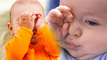 Φυσικές λύσεις για το κάψιμο των ματιών στα μωρά