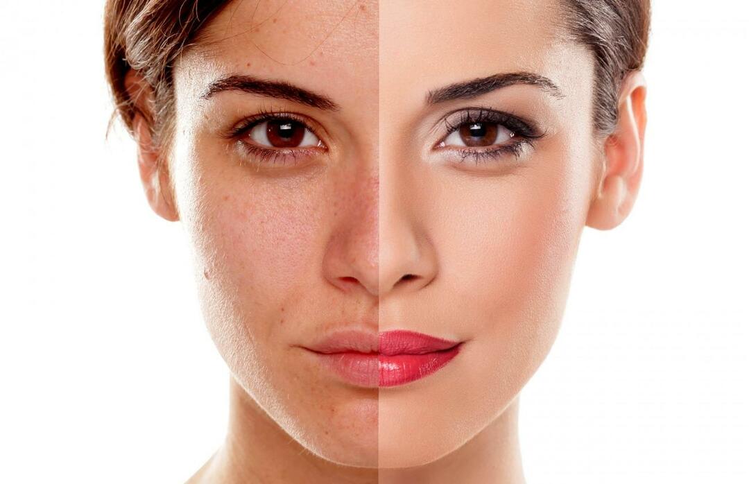 Πώς θα αποτρέψουμε το δέρμα να δείχνει κουρασμένο; Πώς να μειώσετε την κουρασμένη εμφάνιση του δέρματος;
