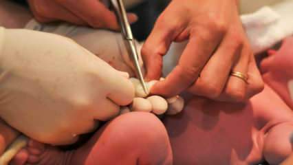 Πότε κόβεται ο ομφάλιος λώρος στα μωρά; Οφέλη από την αργή κοπή του ομφάλιου λώρου