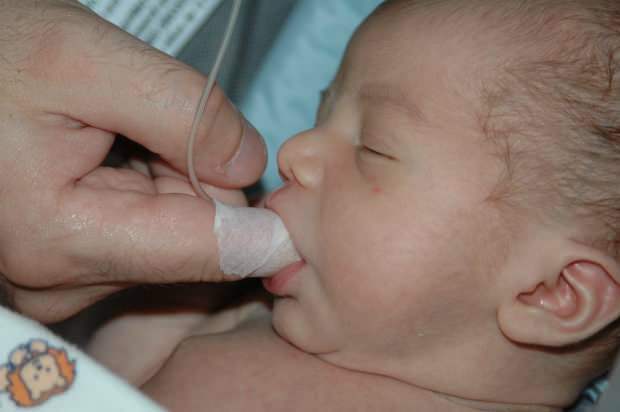 Ποια είναι η μέθοδος Finger Feeding; Πώς να ταΐσετε το μωρό με μια σύριγγα;