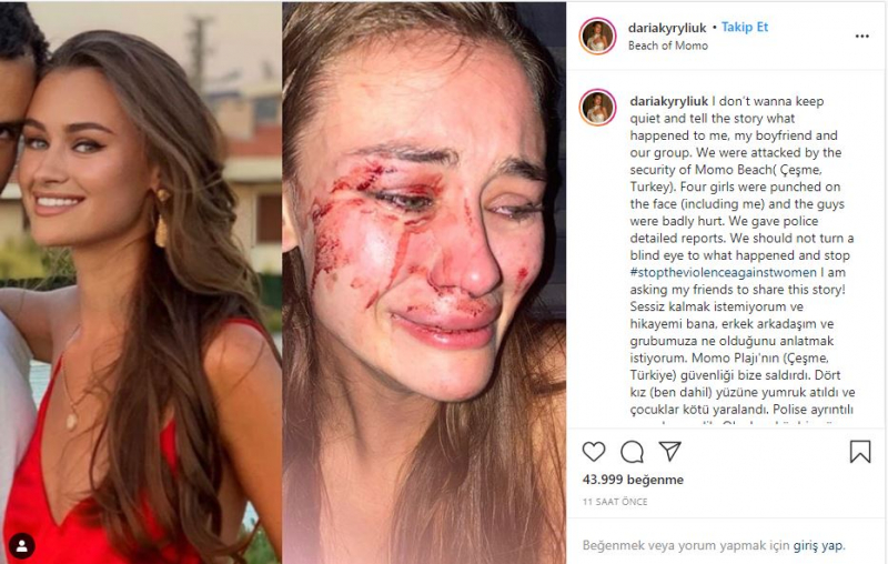 Το κορυφαίο μοντέλο της Ουκρανίας Daria Kyryliuk, που φέρεται να χτυπήθηκε στο Σμύρνη Τσεσμέ, μίλησε για πρώτη φορά!