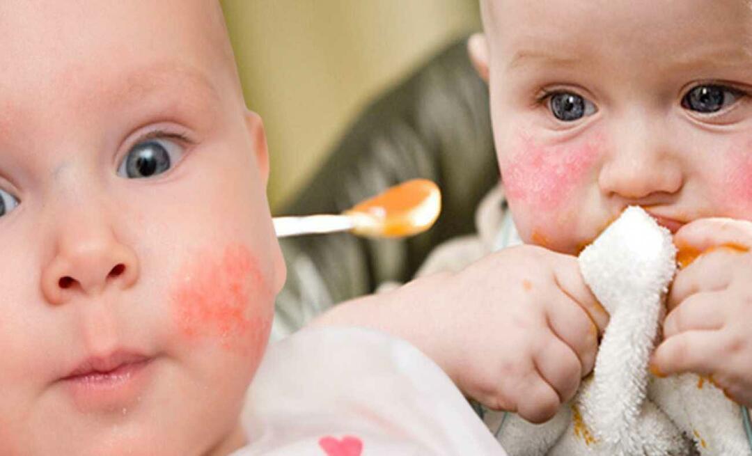 Τι πρέπει να τρώει ένα μωρό με αλλεργίες; Ποιες είναι οι εναλλακτικές τροφές για τα αλλεργικά μωρά;